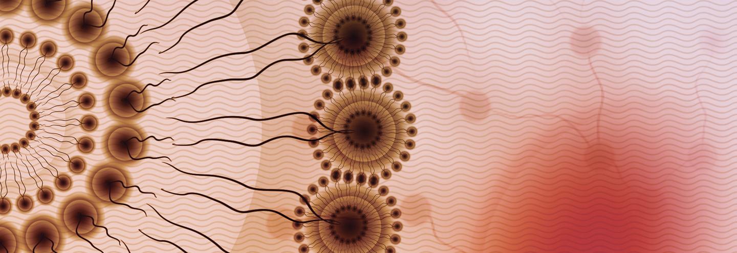 Meeting the Growing Need for Complex Injectable Product Development and Manufacturing