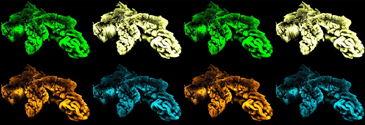 Accelerating Drug Development with AI-Enabled 3D Spatial Biology