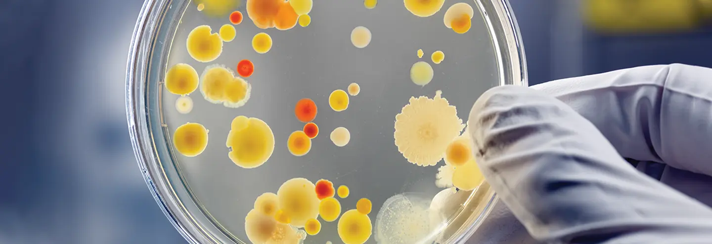 Supporting AAV and Lentiviral Vector Development and Commercialization